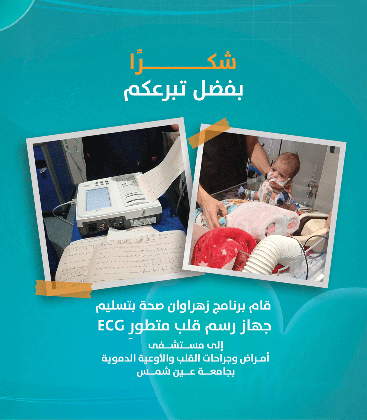 تسليم جهاز رسم قلب (ECG) إلى مستشفى أمراض وجراحات القلب والأوعية الدموية بجامعة عين شمس.